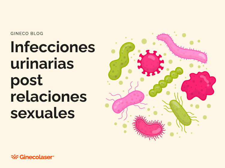 Infecciones urinarias post relaciones sexuales