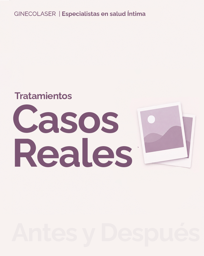 Caos reales