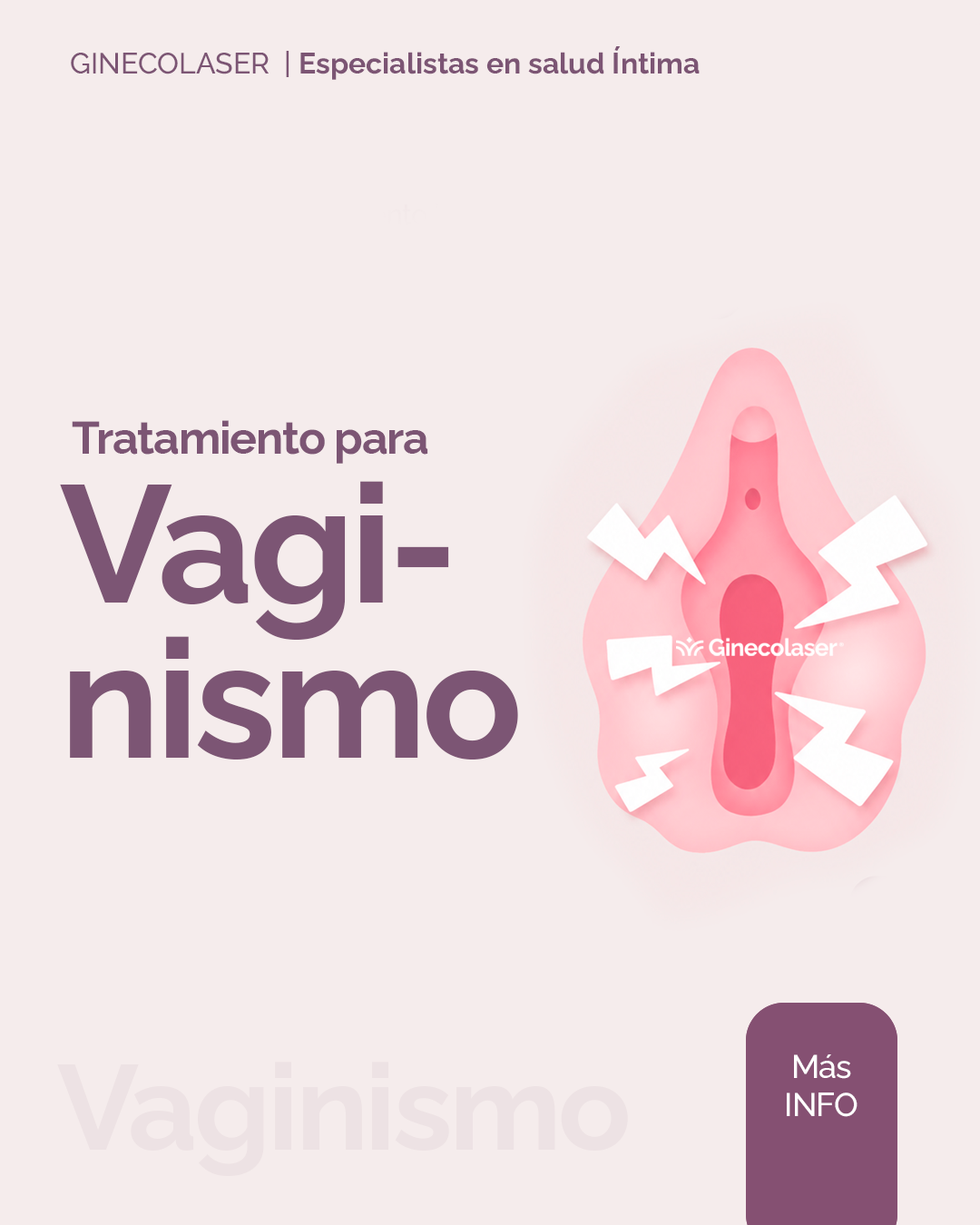 Vaginismo