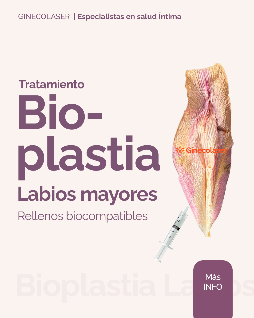 Bioplastia labios mayores (rellenos biocompatibles en zona genital. Fillers)