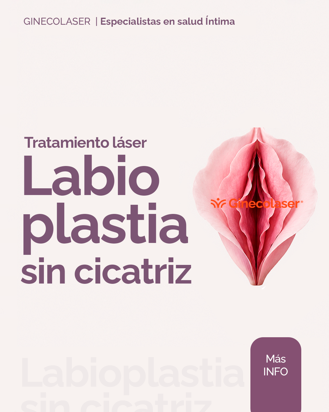 Labioplastia sin cicatriz