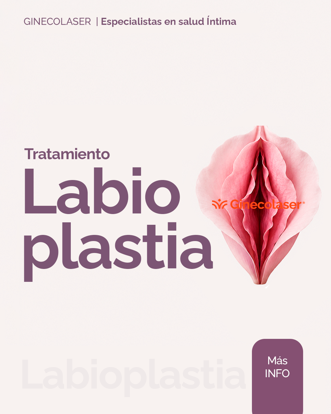 Labioplastia