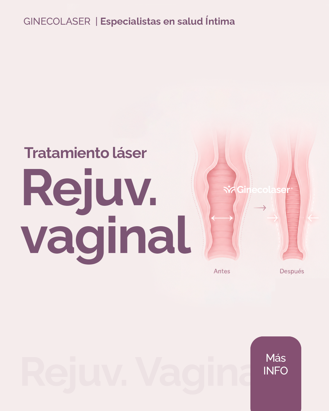 Rejuvenecimiento vaginal