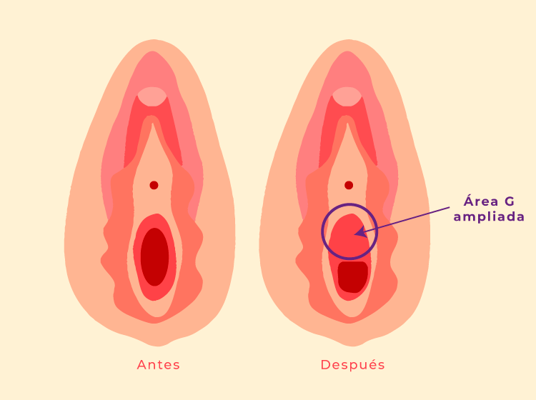 G-Spot Enhancement