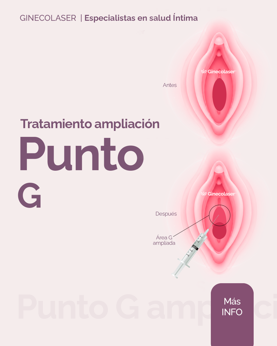 Ampliación del punto G