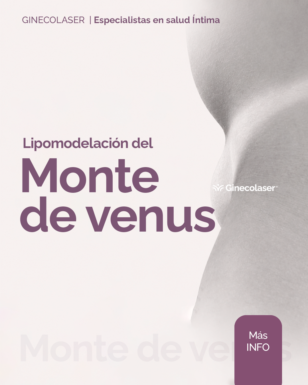 Lipomodelación del monte de venus