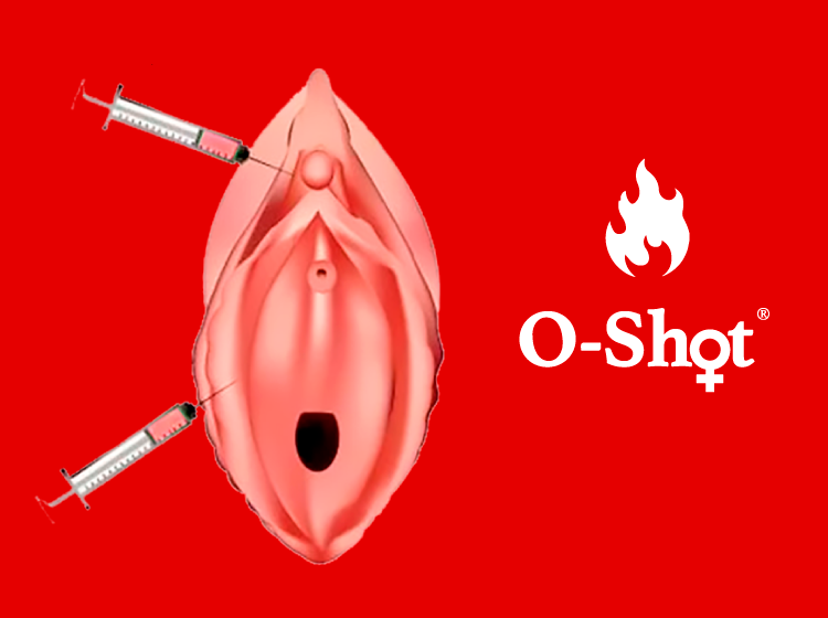 O-shot 