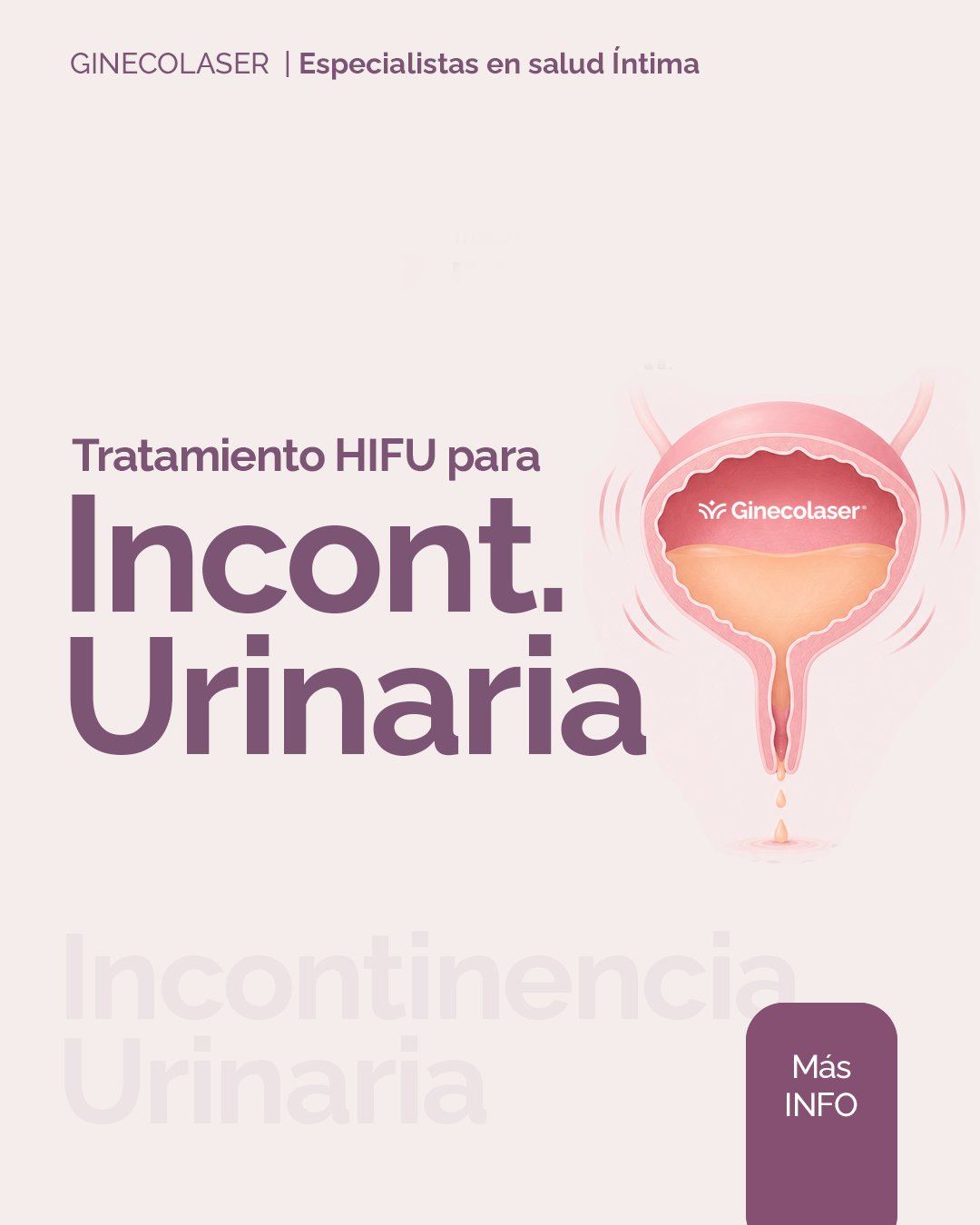 Incontinencia urinaria de esfuerzo (IOE)