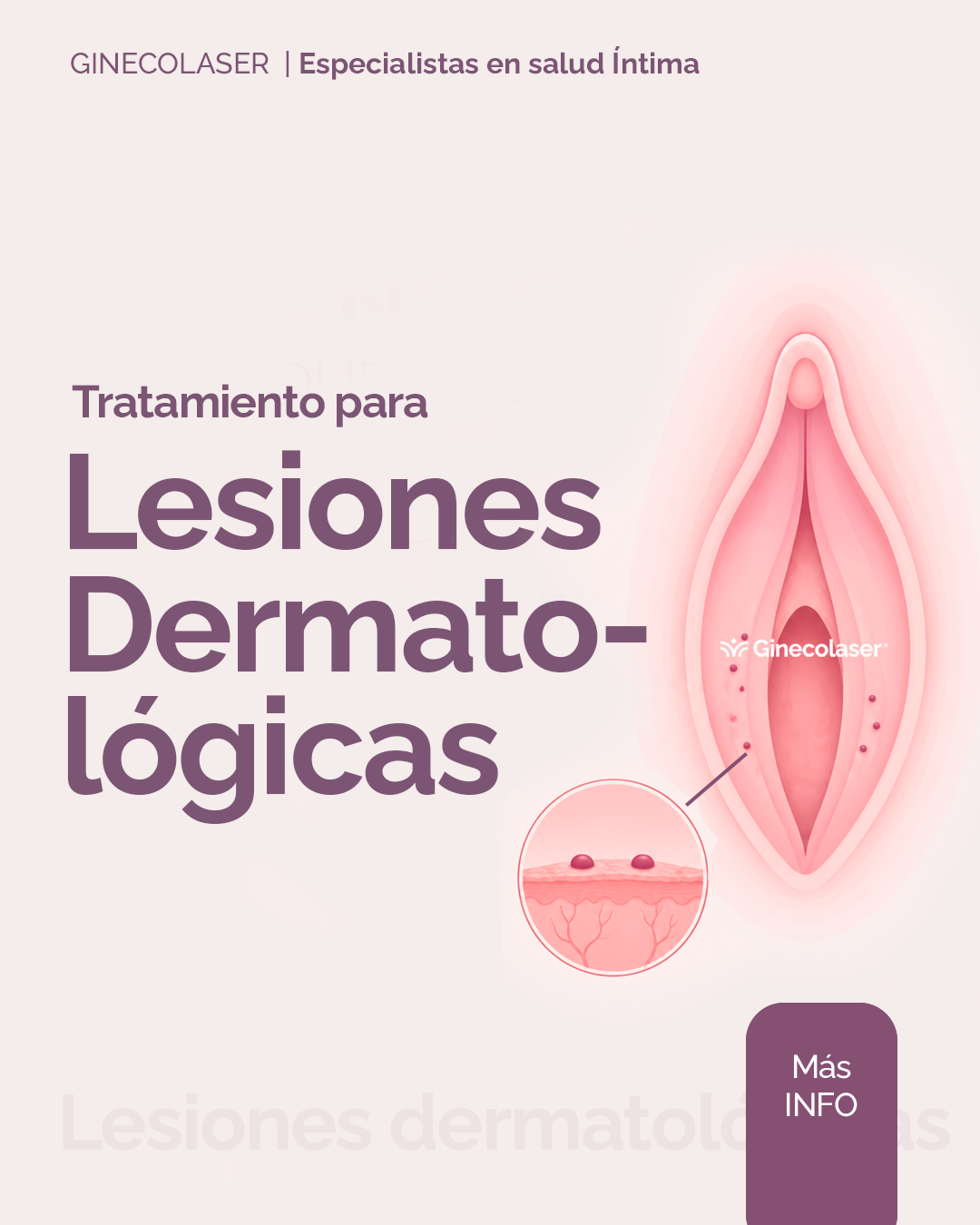 Tratamientos para lesiones dermatológicas 
