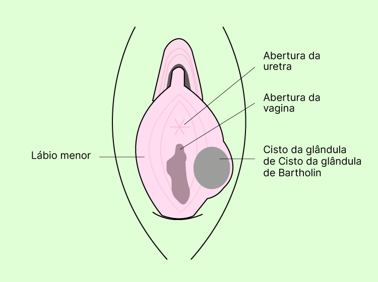 Glândula de Bartholin
