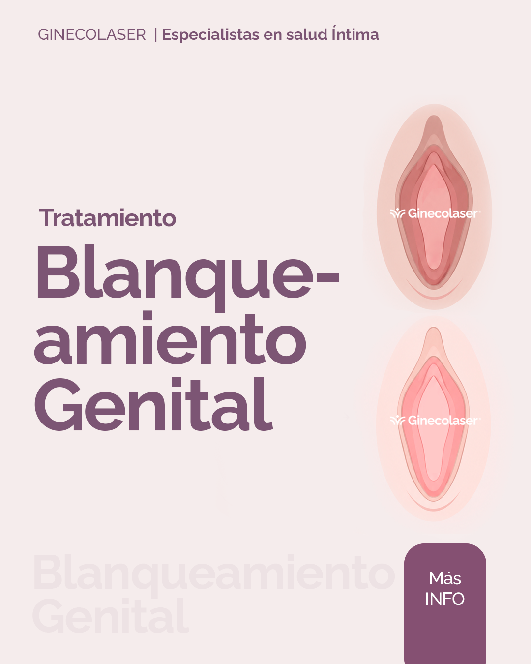 Blanqueamiento Genital
